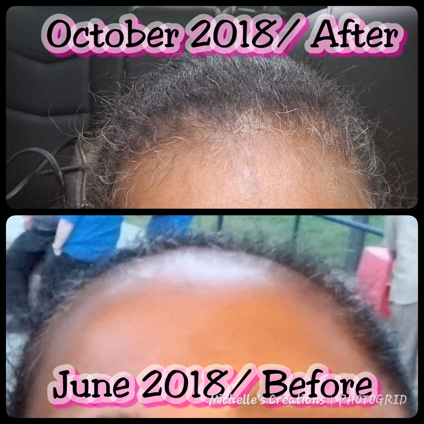 Hair Growth Oil